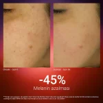 Radiant Forte Intensive Cream