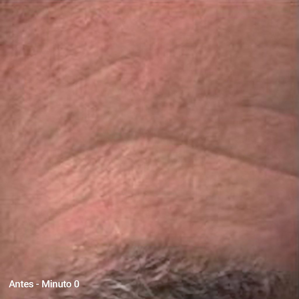 Before image