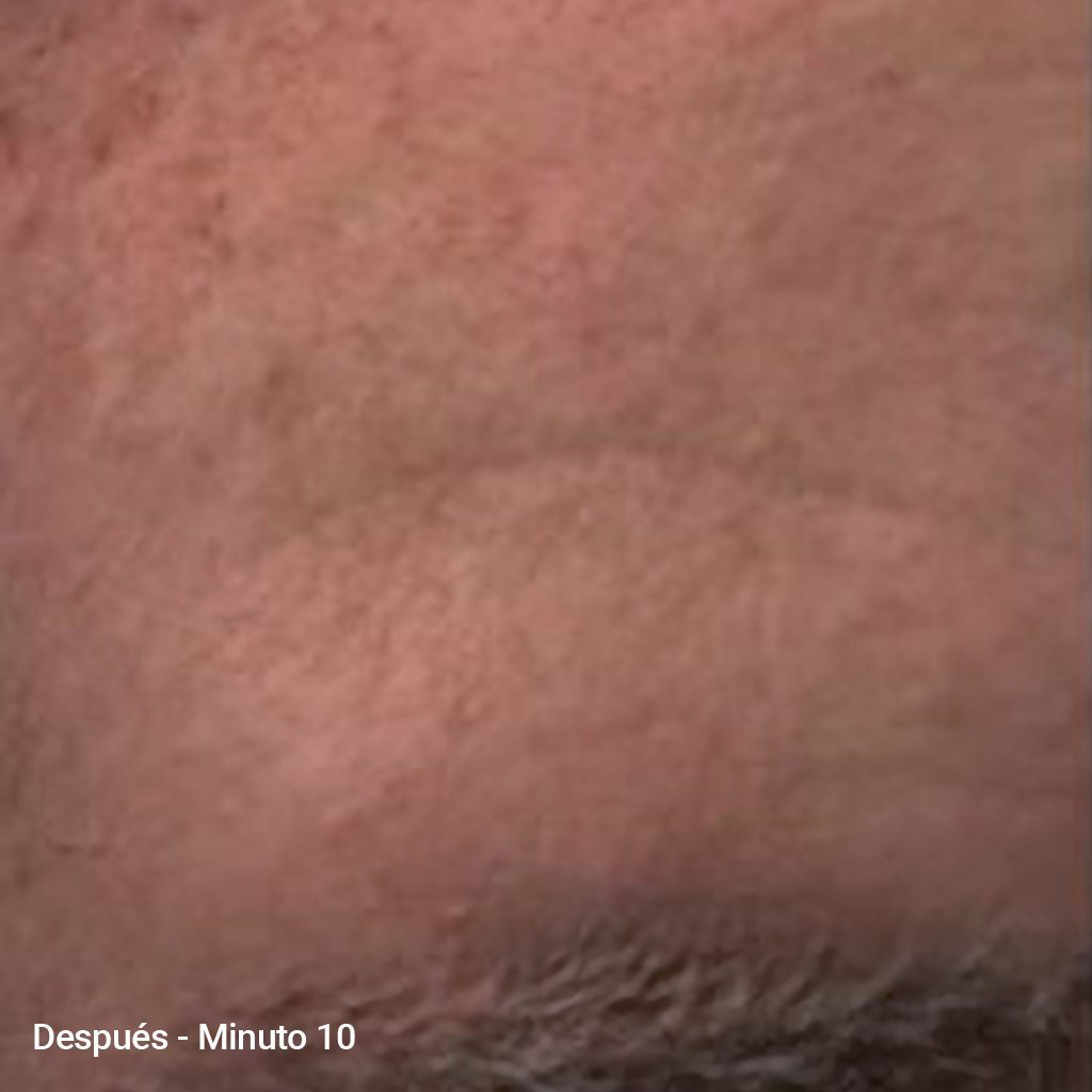 After image