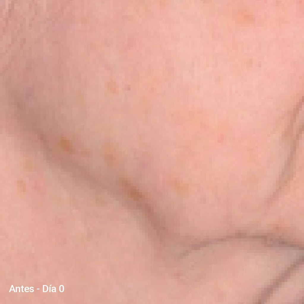 Before image